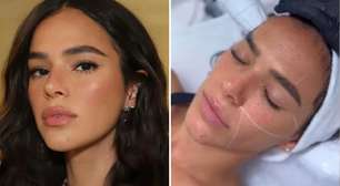 Laser na boca? O segredo por trás do novo procedimento estético de Bruna Marquezine
