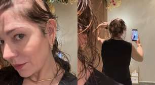 Mãe de Lucas Lucco faz vídeo mostrando efeitos da alopecia e desabafa: 'Meu filho chorou'