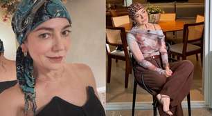 Alopecia: Mãe de Lucas Lucco revela doença e faz desabafo emocionante