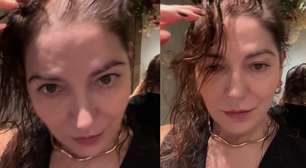 Mãe de Lucas Lucco diz que 'filho chorou' ao mostrar efeitos de sua alopecia: 'Sente a nossa dor'