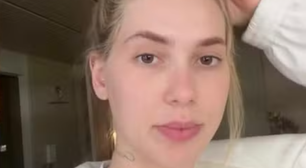 Virginia Fonseca fala sobre enxaqueca e atraso no tratamento: 'Muita dor'