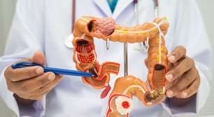 Câncer colorretal: entenda o impacto do consumo de ultraprocessados na saúde intestinal