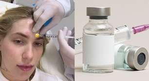 Botox no controle da enxaqueca; saiba o que diz especialista sobre tratamento usado por Virgínia