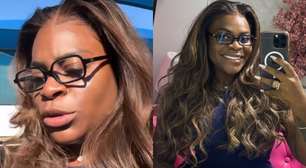 Jojo Todynho planeja mexer no nariz e reforça: 'Só uma levantadinha'