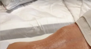 Sequíssima! Mãe de Virginia Fonseca mostra resultado de cirurgias: 'Spoiler'