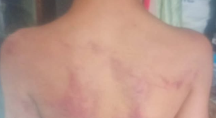 Polícia Civil investiga agressão contra criança de 10 anos no bairro Vera Cruz, em Passo Fundo