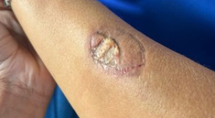 Mãe de aluno morde vice-diretora e funcionários de escola após discussão por uso de uniforme, diz TV