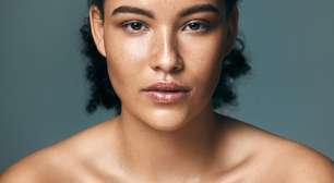 Melasma emocional? Veja como o estresse pode influenciar as manchas