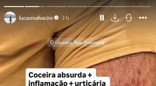 Lucas Malvacini vai parar no hospital na Indonésia após ataque de ácaros