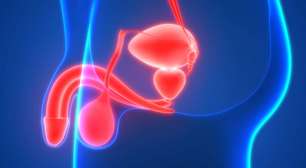 Hipospádia: causas, sintomas e tratamento da alteração urogenital em meninos