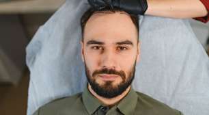 Transplante capilar: entenda quando pode ser necessário refazer o procedimento