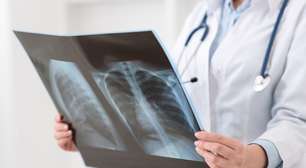 Milhões de pessoas são portadoras da bactéria causadora da tuberculose sem saber