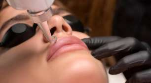 Como remover tatuagem: métodos, custos e resultados