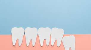 Dente do siso: por que algumas pessoas não têm?