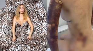 Após dezenas de cirurgias e R$ 500 mil gastos, Ju Isen revela tratar dismorfia há mais de um ano