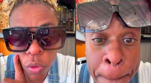 Alerta! Cacau Protásio tem perda de visão após usar pomada capilar