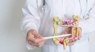 Novas diretrizes para a Doença de Crohn recomendam o uso de medicamentos avançados como primeira opção