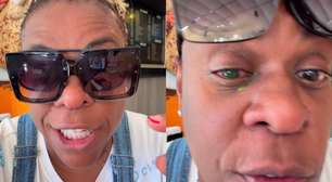 Cacau Protásio relata problema grave no olho e perda temporária da visão após uso de pomada capilar