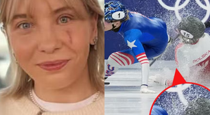 Atleta atingida por lâmina no rosto nos Jogos de Inverno mostra a cicatriz e revela sequela