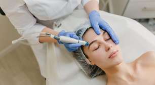 Adeus bichectomia? Novas tendências de estética facial crescem