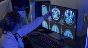 Cientistas descobrem depois que remédio mais popular para diabetes afeta o cérebro