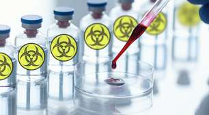 Achávamos que os vírus letais estavam trancados a sete chaves até polícia revelar o sumiço de um vírus perigoso no maior laboratório de segurança do Brasil