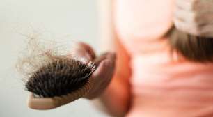 Queda capilar após uso de Mounjaro: efeito colateral comum pode ser evitado; saiba como