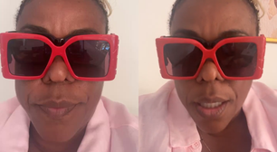 Cacau Protásio atualiza estado de saúde após cegueira temporária: 'Meu olho ficou verde'