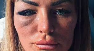 'Não aceitei sair com um lutador de MMA e ele me deu um soco'