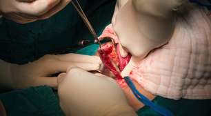 Cirurgia de apêndice: técnicas minimamente invasivas e alta mais cedo