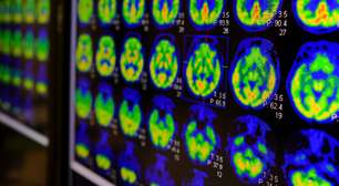 Esqueça as biópsias dolorosas porque a ciência acaba de revelar a tecnologia inesperada que funciona como uma lanterna contra o câncer