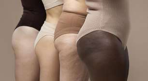 Lipedema vai além da estética e pode ter relação hormonal