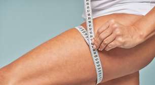 Lipedema exige avaliação clínica e tratamento personalizado