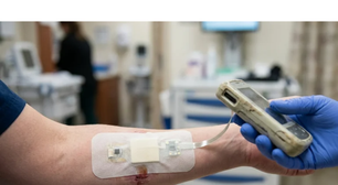 Esqueça a angústia de esperar as feridas cicatrizarem porque a ciência acaba de inventar uma tecnologia incrível que previne infecções