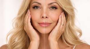 Banco do colágeno: o segredo para driblar o envelhecimento antes dos sinais