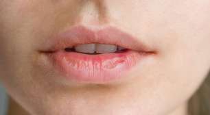 Boca seca o tempo todo? Veja possíveis causas e quando investigar