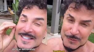 Latino reage após virar alvo de críticas sobre harmonização facial: 'Parem com essa hipocrisia'