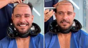 Diogo Nogueira raspa a cabeça e fãs suspeitam procedimento: 'Não faça'