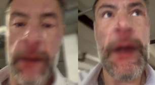 Após acusação de violência doméstica, deputado Fernando Marangoni diz ter sido agredido por esposa