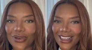 O que aconteceu com Ludmilla? Especialistas fazem alerta sobre novo rosto da cantora: