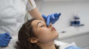 7 mitos sobre a rinoplastia