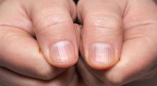 Um sinal discreto nos dedos pode estar ligado ao pulmão; veja qual é