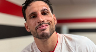 Calleri leva 8 pontos na sobrancelha após choque em São Paulo x Cruzeiro