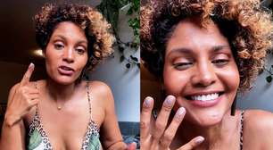 Bárbara Reis relata sinais ignorados por anos até descobrir lipedema: 'Achei que o problema era eu'