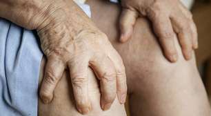 Varizes: nem toda dor nas pernas vem delas