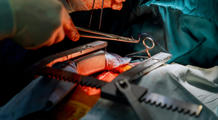 Qual o valor de uma cirurgia de coração? Veja o que influencia no custo