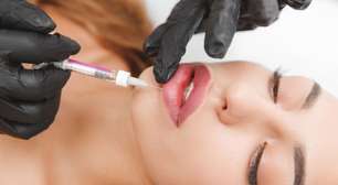 Boca linda por mais tempo: como prolongar o preenchimento labial