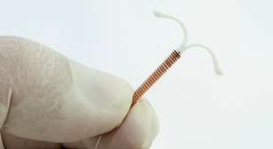 DIU hormonal e risco de câncer de mama: o que se sabe sobre esse elo