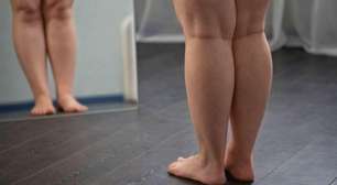 41% das mulheres já deixaram de postar fotos por causa da celulite