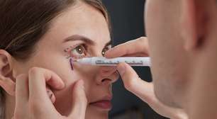Blefaroplastia: a cirurgia que rejuvenesce o olhar